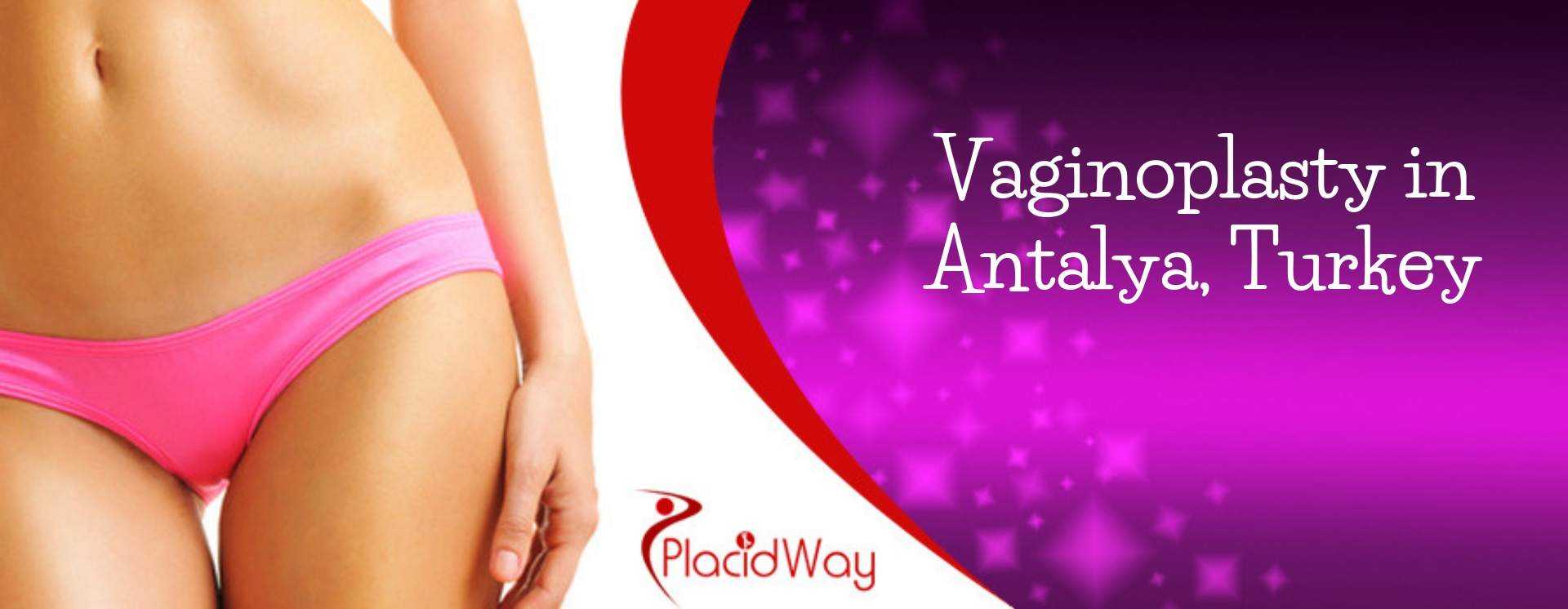 Vaginoplasty in Antalya, Turkey
